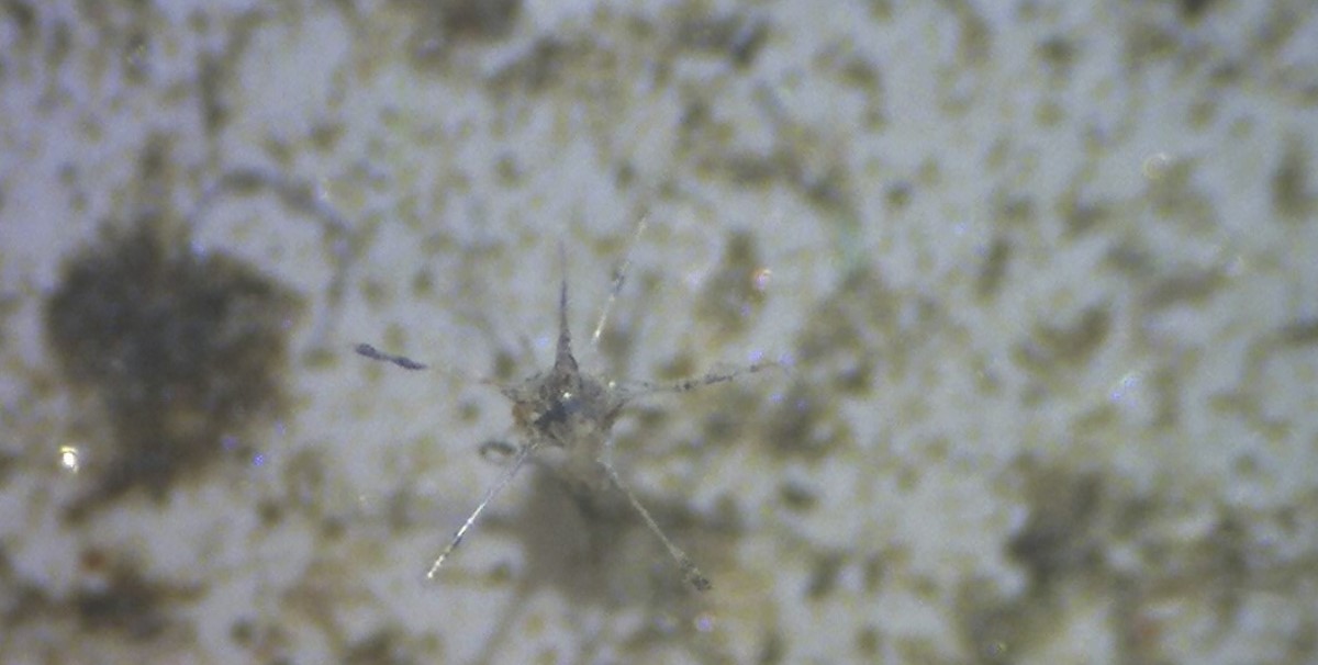 Little critters on the filter: a radiolarian (?) Little critters on the filter: a radiolarian (?)