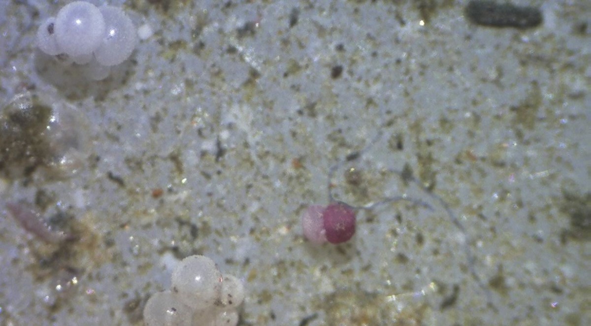 Little critters on the filter: foraminifera Little critters on the filter: foraminifera